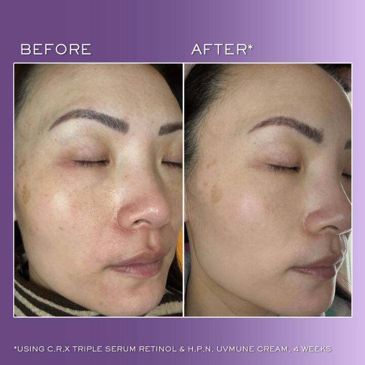 Renergie C.R.X. Triple Serum Retinol 50ml