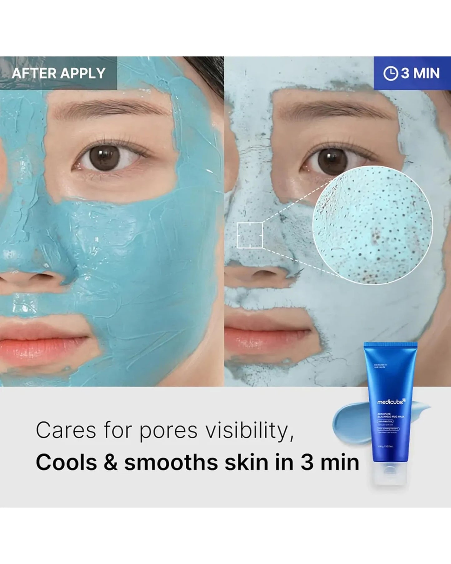 Medicube Zero Pore Blackhead Mud Mask 100g