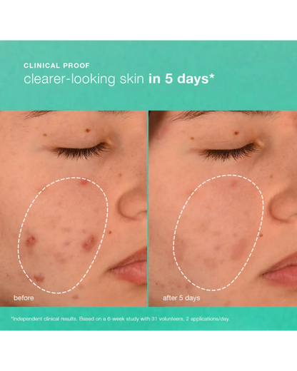 Dermalogica Breakout Biotic Moisturiser 50ml