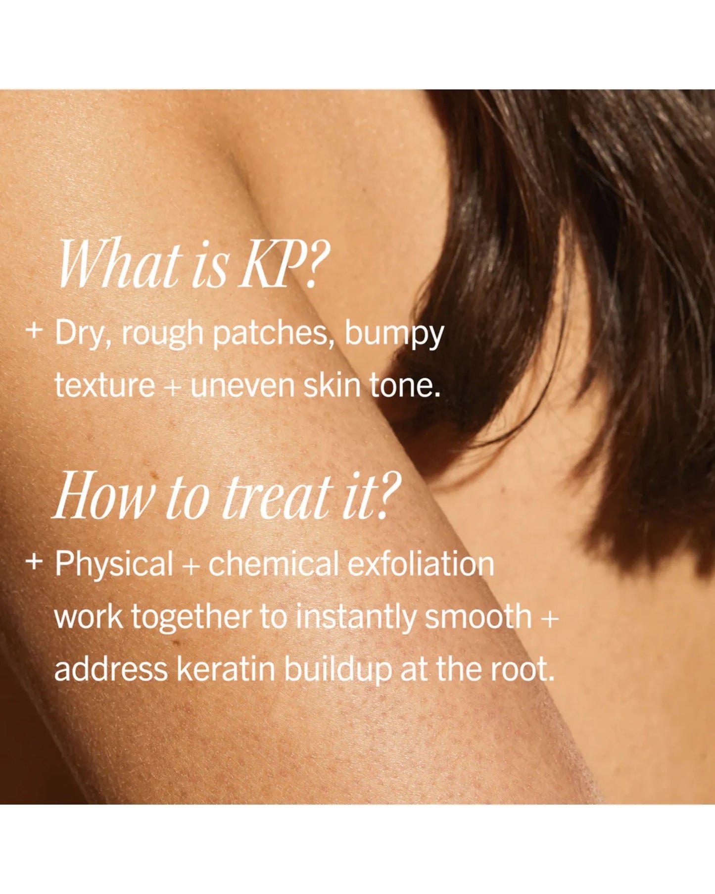 KP Bump Eraser Body Scrub 10% AHA - Fresh Peach 226g