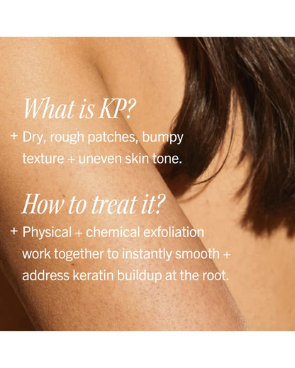 KP Bump Eraser Body Scrub 10% AHA - Fresh Peach 226g