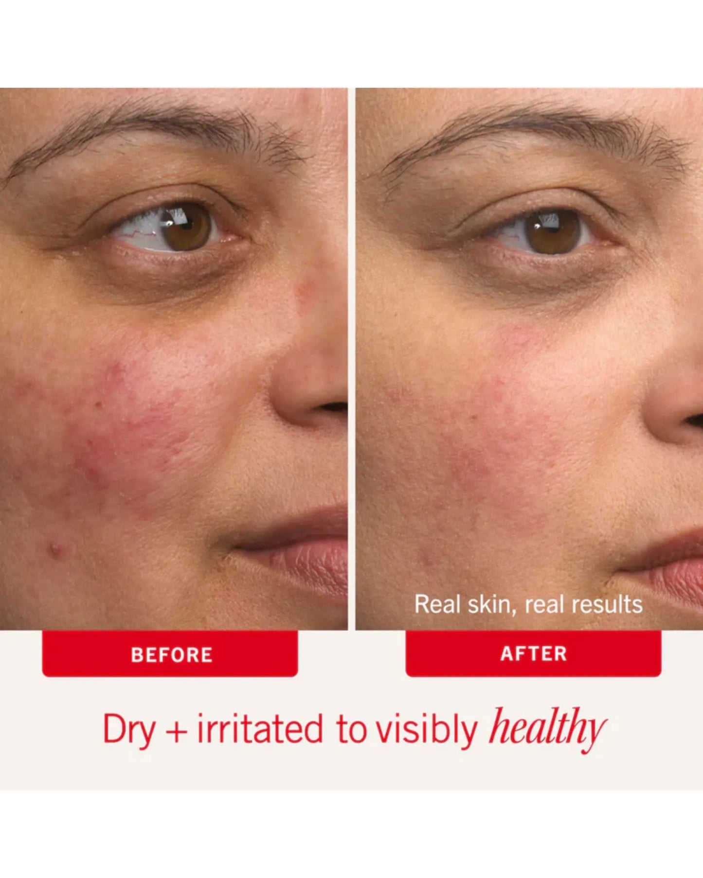 Ultra Repair Cream Intense Hydration 226g