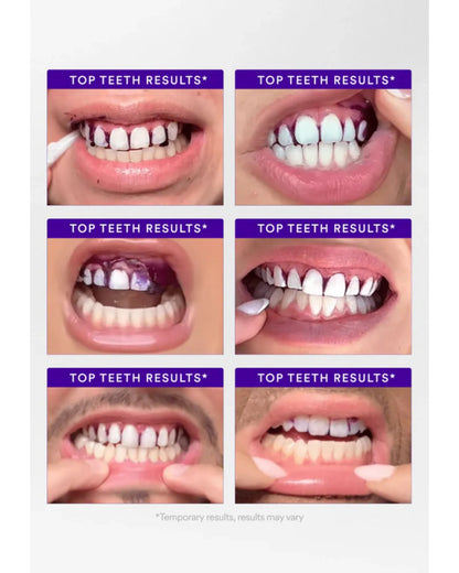 hismile V34 Teeth Whitening Strips 14 Pack