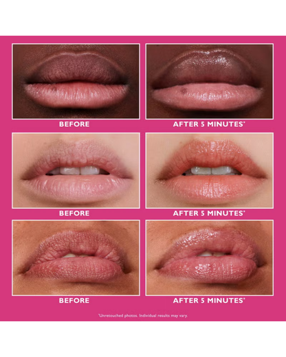 Instant FIRMx Lip Filler 10ml