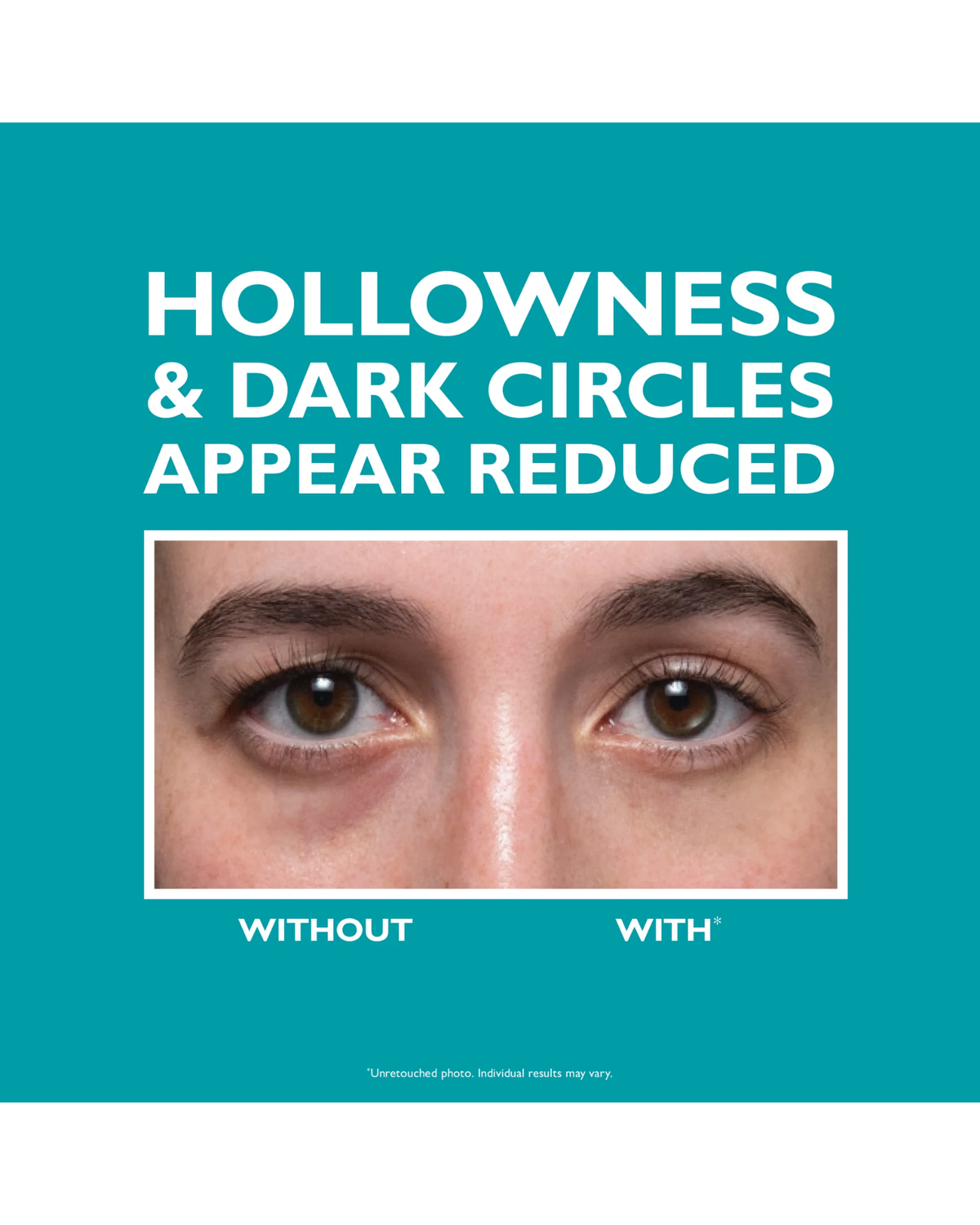 Peptide Skinjection Fill + Fix Under-Eye Cream 15ml