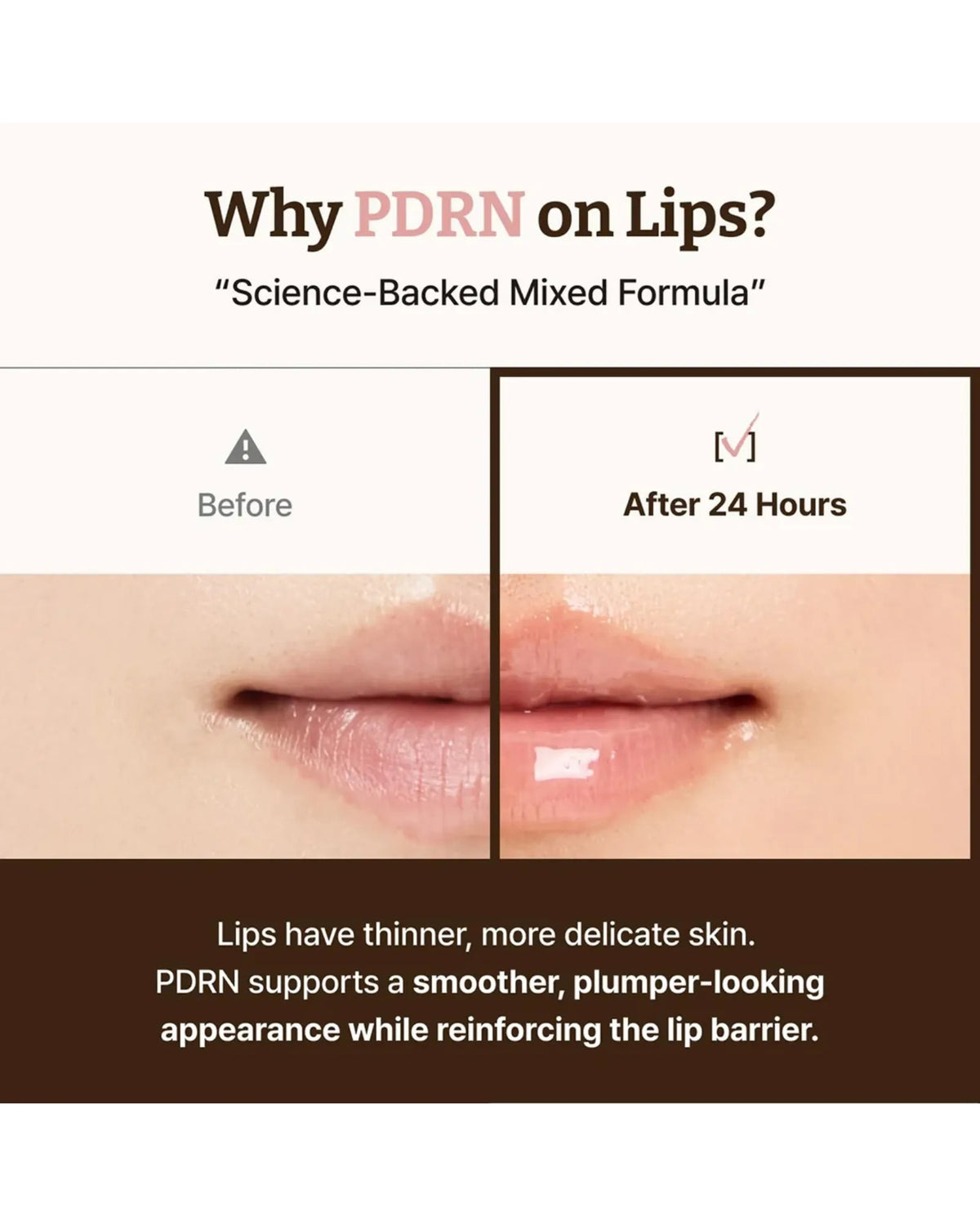 Dr Reju-All Advanced PDRN Rejuvenating Lip Serum 10ml