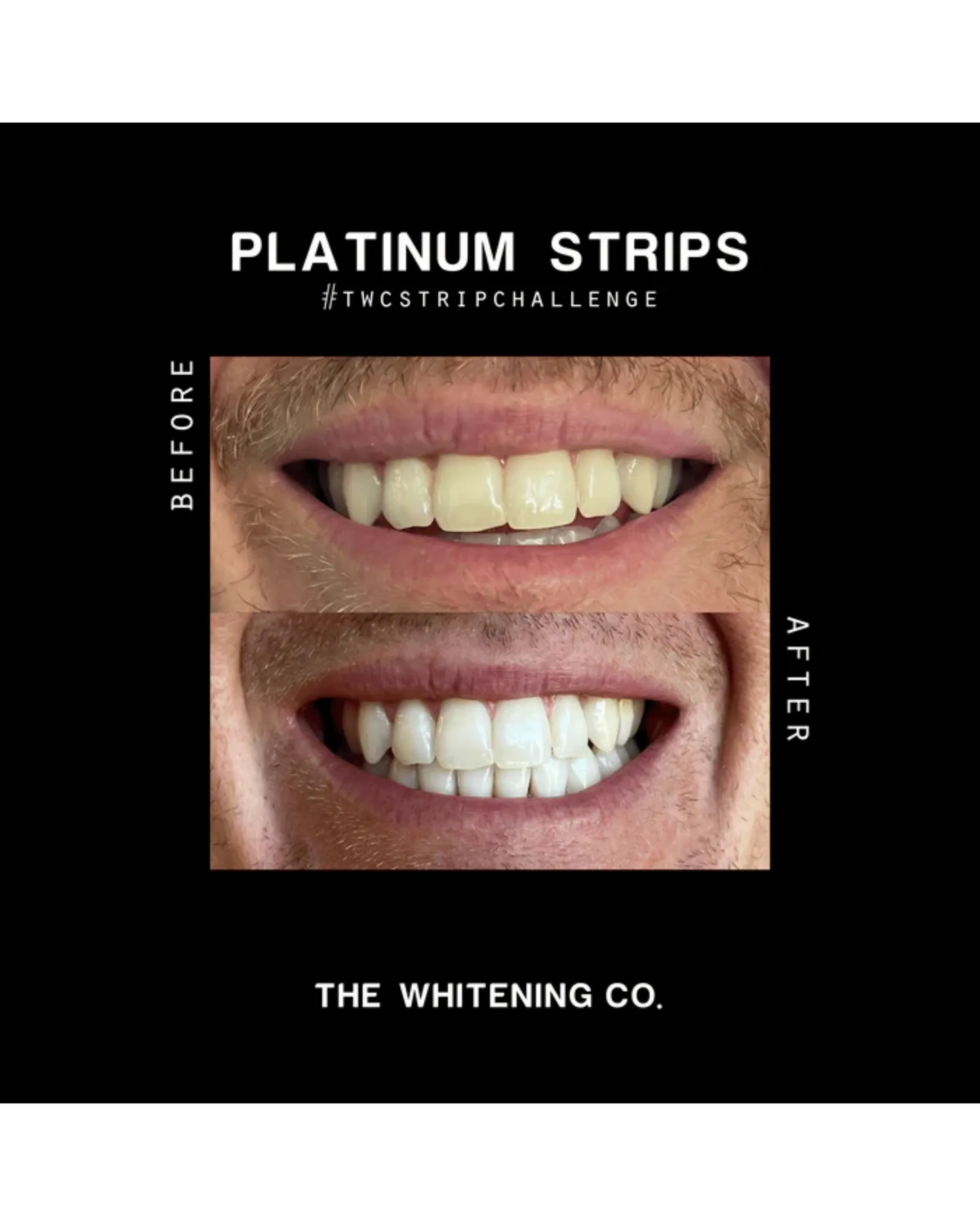 Platinum Strips 14s